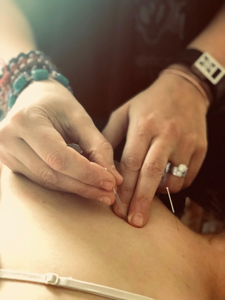 Healing Hands of Acupuncture